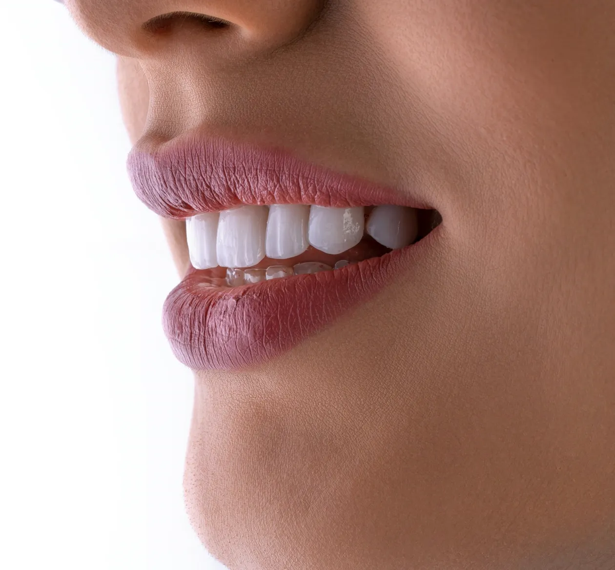 Sorriso com dentes brancos e alinhados